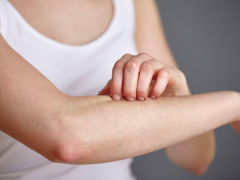 Guide: Minimer risikoen for parfumeallergi