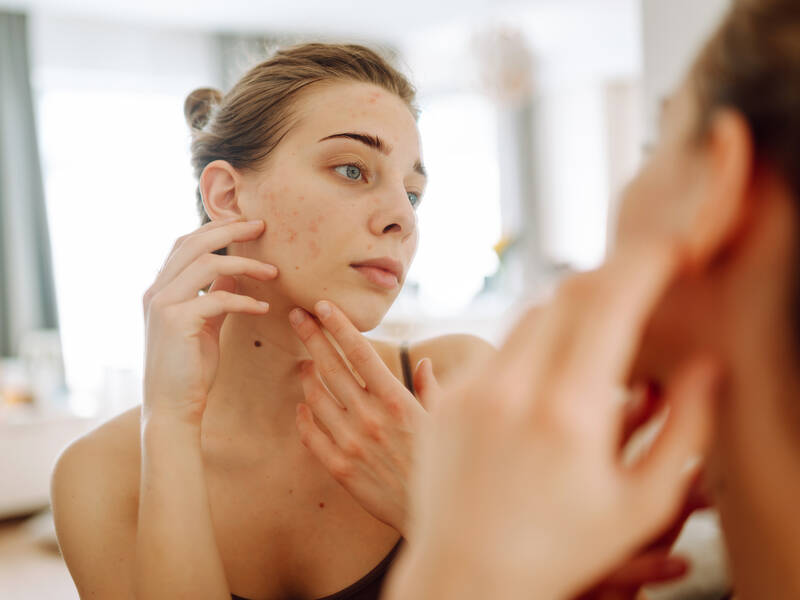 Talgknopper: Hvad er det, og hvad gør du ved det?