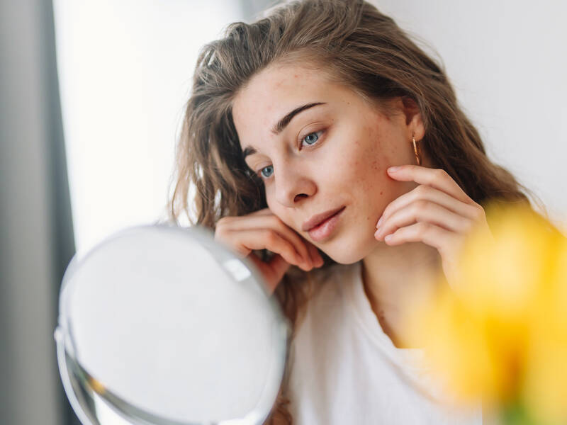 Hvad er forskellen på hudtype og hudtilstand?