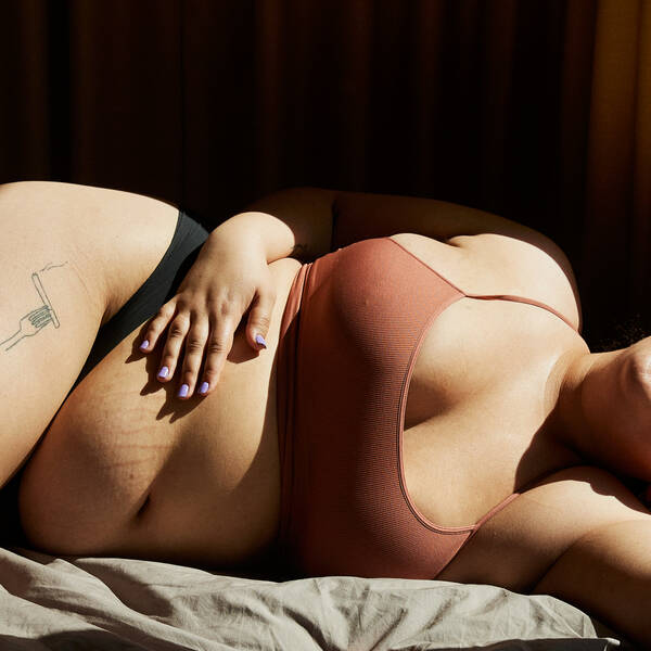 Strækmærker – kan de forebygges eller fjernes? 