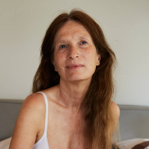 Alt om pigmentpletter: Eksperten guider