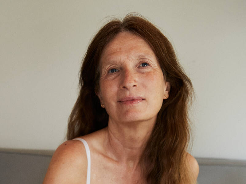 Alt om pigmentpletter: Eksperten guider