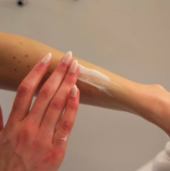 Sådan kommer du bedst gennem en solskoldning