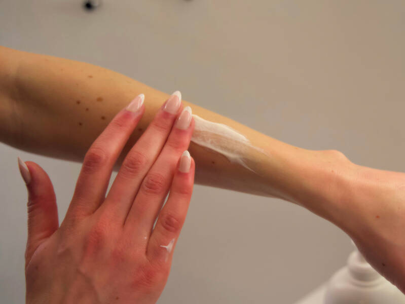 Sådan kommer du bedst gennem en solskoldning